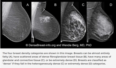 The Dense Breast Dilemma | Story Half Told